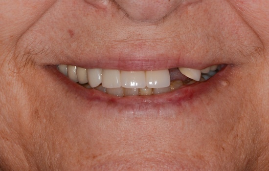 Case 7 before