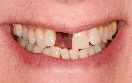 Case 1 before