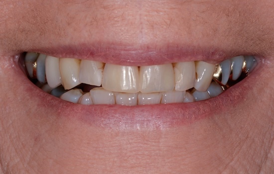 Case 2 after