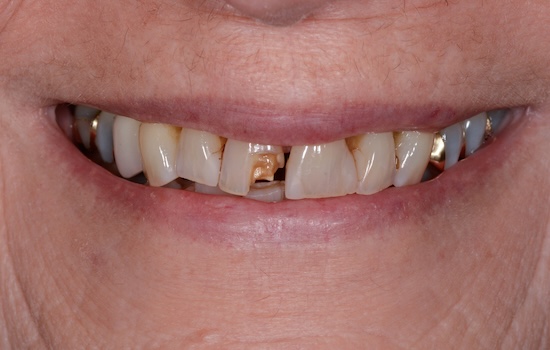 Case 2 before