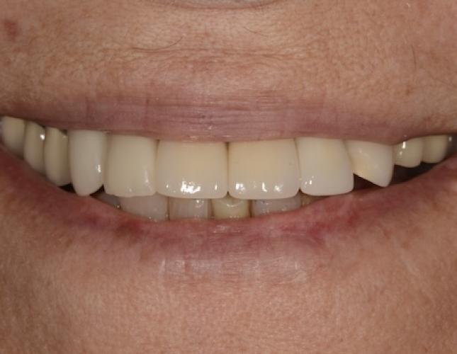 Case 7 after
