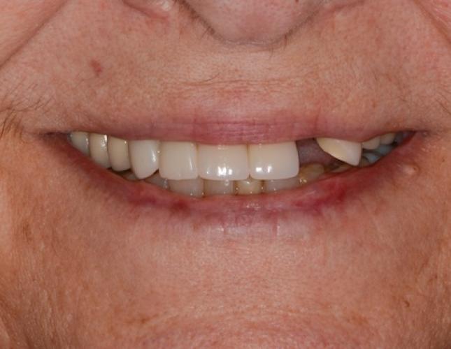 Case 7 before