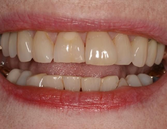 Case 8 after