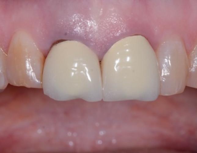 Case 6 before