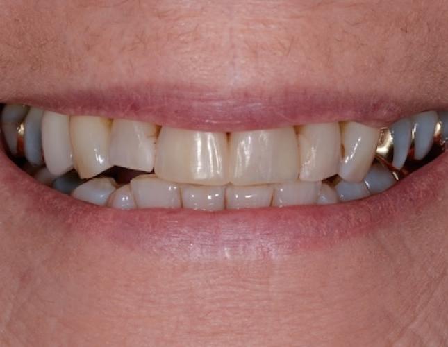 Case 2 after
