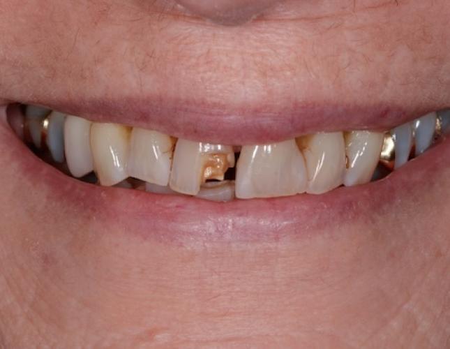 Case 2 before