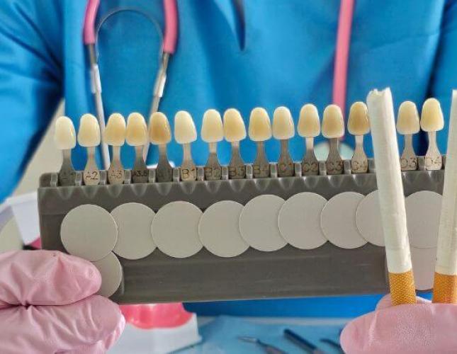 How to Prevent Tooth Staining and Keep Your Smile Bright