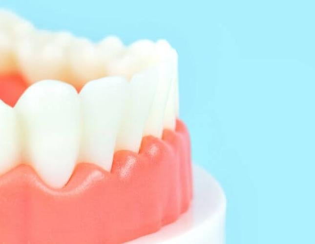 Your Path to Healthier Gums: Understanding Pocket Reduction Surgery